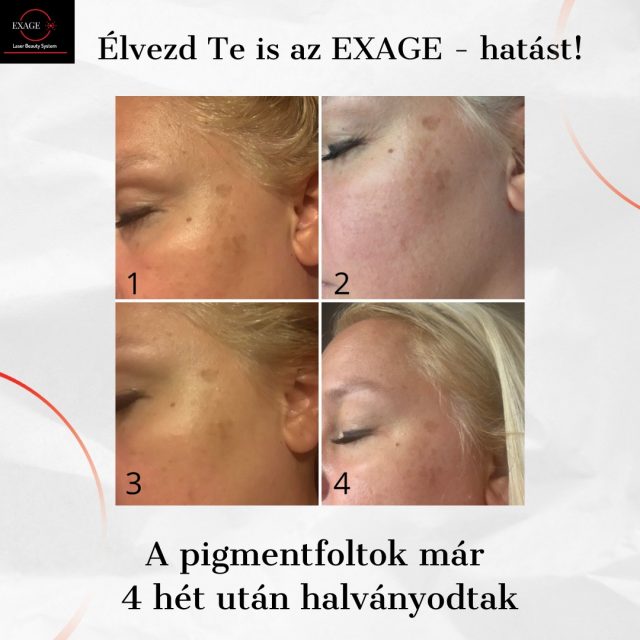 Exage Zs.