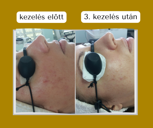 Csillag Mónika Előtte Utána (002)